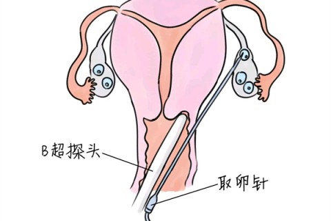 http://huizhou.vdtfzz.com/post/205.html|惠州供卵助孕